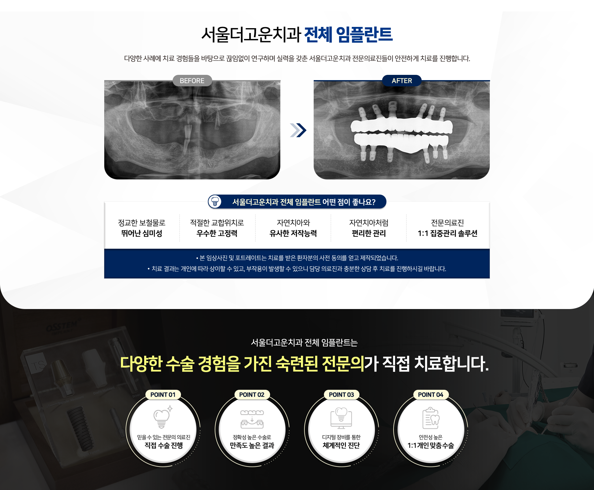 서울더고운치과 전체 임플란트