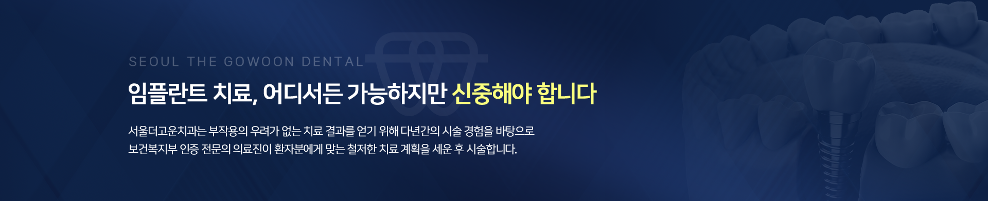 서울더고운치과 임플란트를 믿을 수 있는 이유