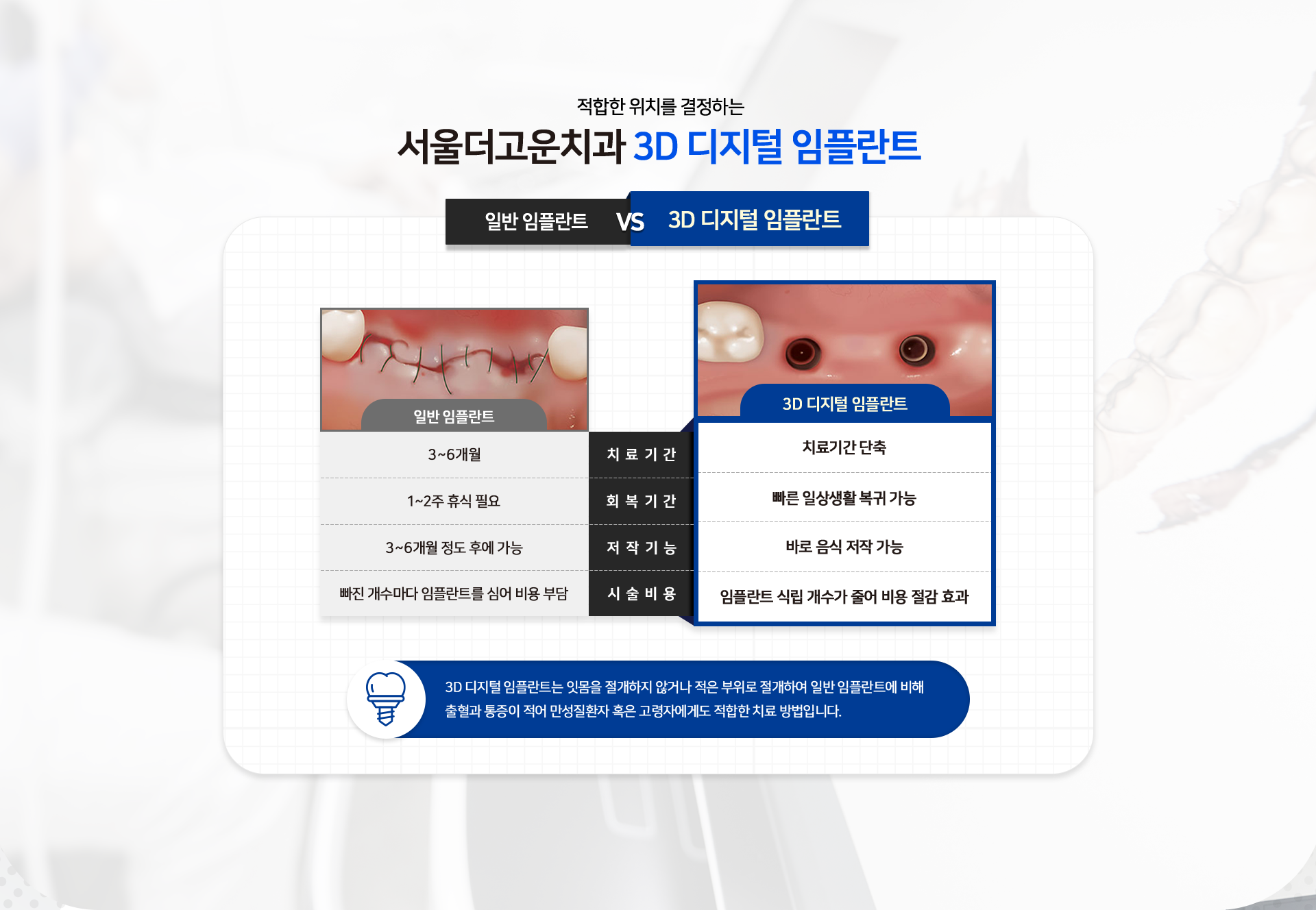 적합한 위치를 결정하는 서울더고운치과 3D 디지털 임플란트