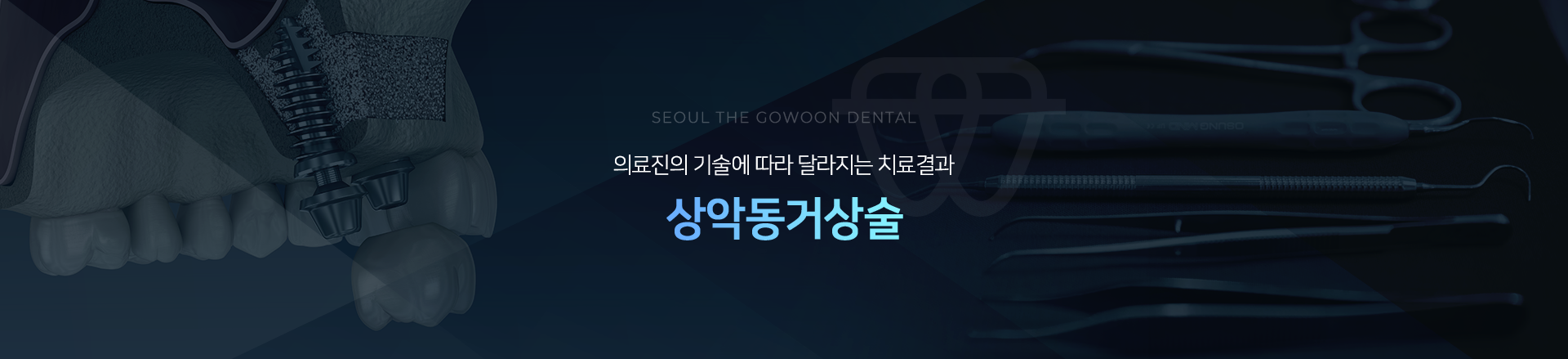 의료진의-기술에-따라-달라지는-치료결과-상악동거상술