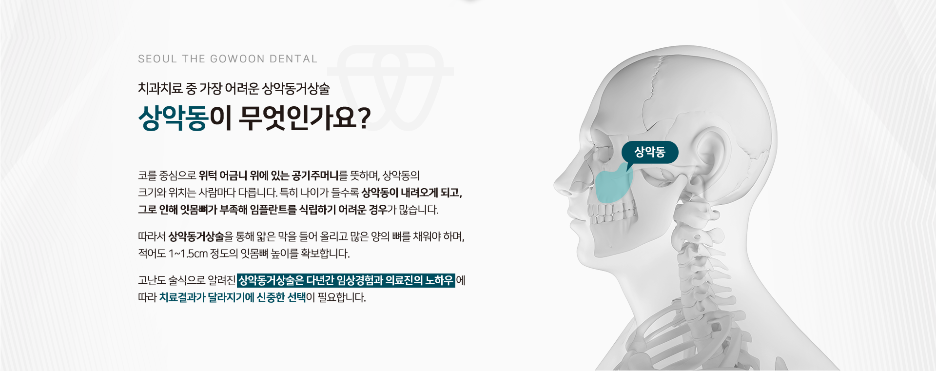 치과치료-중-가장-어려운-상악동거상술-상악동이-무엇인가요?-코를-중심으로-위턱-어금니-위에-있는-공기주머니를-뜻하며,-상악동의-크기와-위치는-사람마다-다릅니다.-특히-나이가-들수록-상악동이-내려오게-되고,-그로-인해-잇몸뼈가-부족해-임플란트를-식립하기-어려운-경우가-많습니다.-따라서-상악동거상술을-통해-얇은-막을-들어-올리고-많은-양의-뼈를-채워야-하며,-최소-1~1.5cm-정도의-잇몸뼈-높이를-확보합니다.-고난도-술식으로-알려진-상악동거상술은-풍부한-임상경험과-의료진의-노하우에-따라-치료-결과가-달라지기에-신중한-선택이-필요합니다.