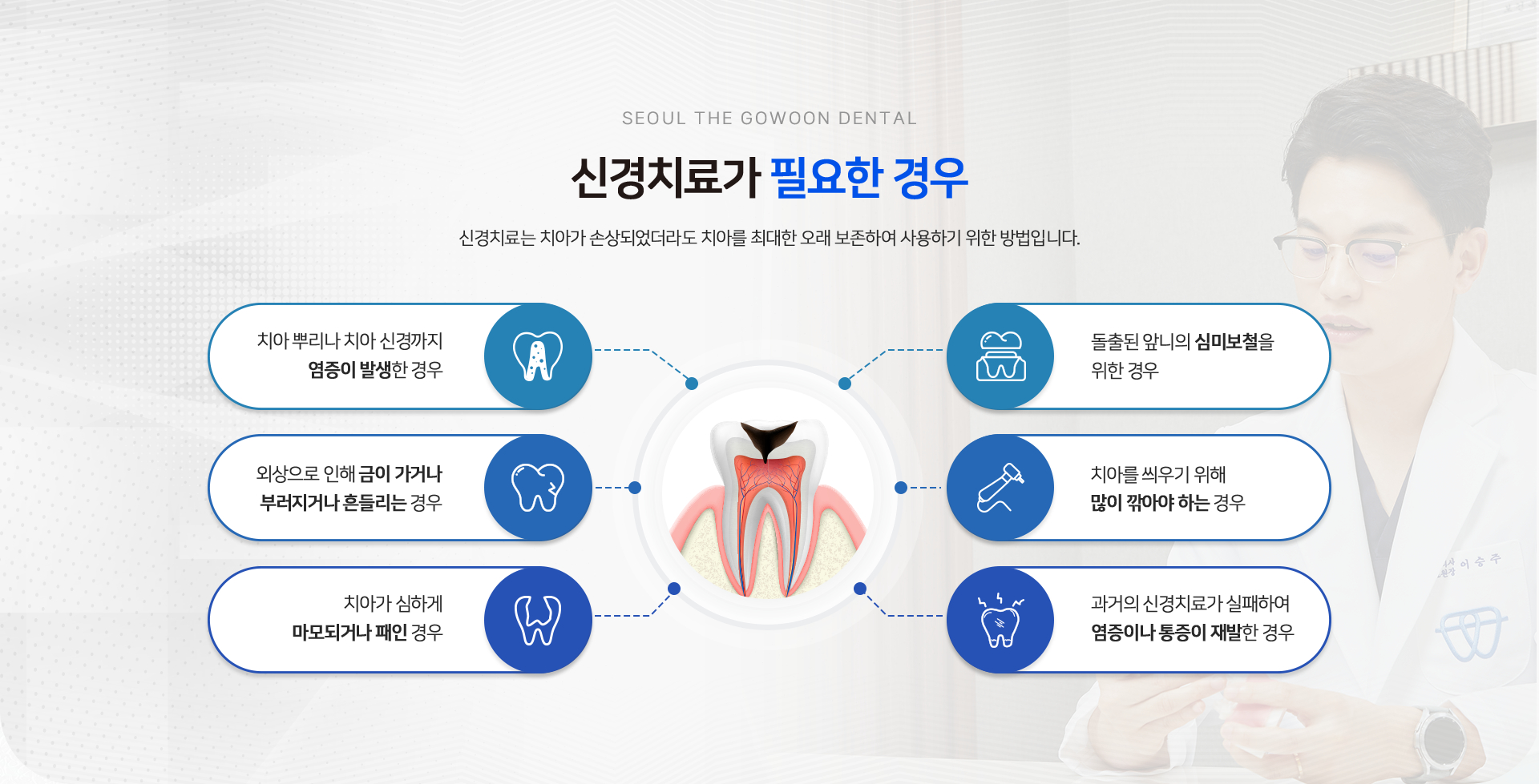 신경치료가-필요한-경우-신경치료는-치아가-손상되었더라도-치아를-최대한-오래-보존하여-사용하기-위한-방법입니다.-치아-뿌리나-치아-신경까지-염증이-발생한-경우-외상으로-인해-금이-가거나-부러지거나-흔들리는-경우-치아가-심하게-마모되거나-패인-경우-돌출된-앞니의-심미보철을-위한-경우-치아를-씌우기-위해-많이-깎아야-하는-경우-과거의-신경치료가-실패하여-염증이나-통증이-재발한-경우 