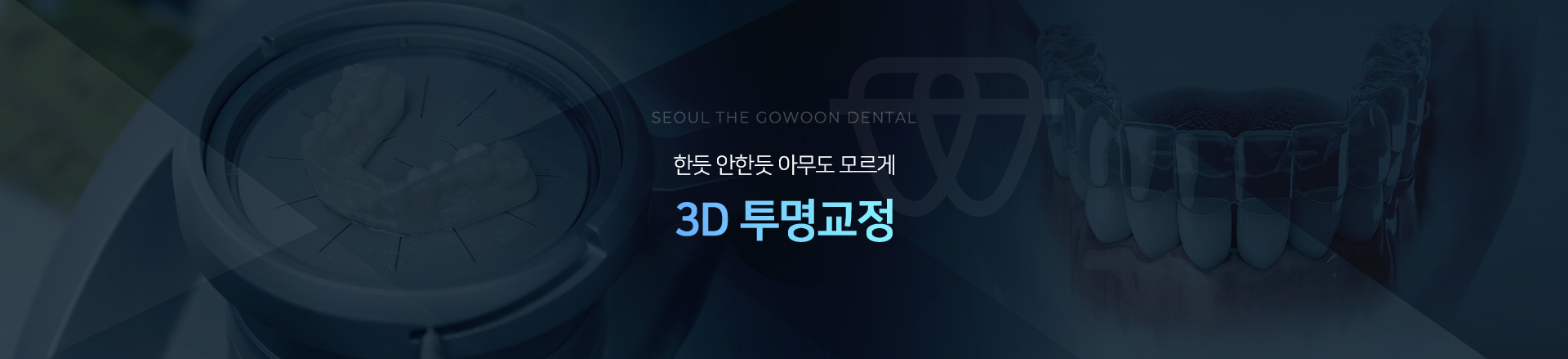 한듯-안한듯-아무도-모르게-3D-투명교정