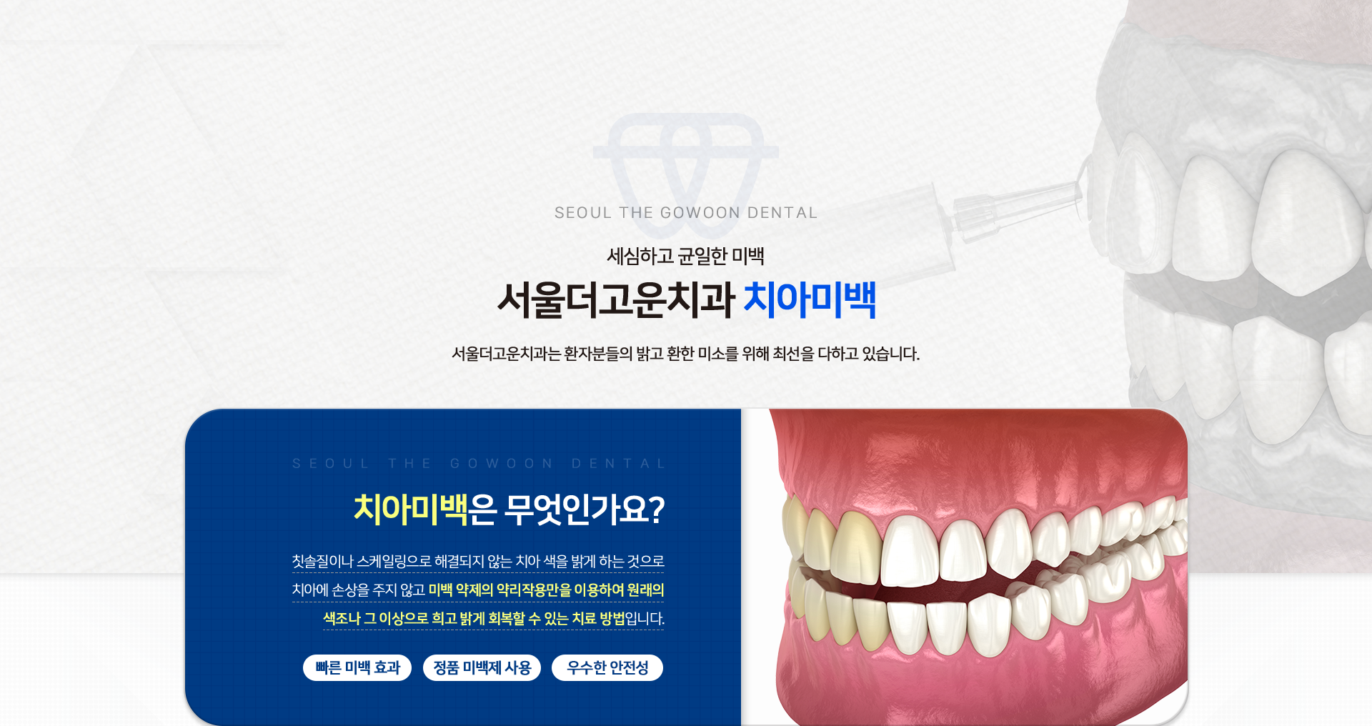 치아의-기능적-심미적-요인을-모두-충족시키고-싶을-땐-서울더고운치과-치아미백-서울더고운치과는-환자분들의-밝고-환한-미소를-위해-최선을-다하고-있습니다.-치아미백은-무엇인가요?-칫솔질이나-스케일링으로-해결되지-않는-치아-색을-밝게-하는-것으로-치아에-손상을-주지-않고-미백-약제의-약리작용만을-이용하여-원래의-색조나-그-이상으로-희고-밝게-회복할-수-있는-치료-방법입니다.-빠른-미백-효과-정품-미백제-사용-우수한-안전성